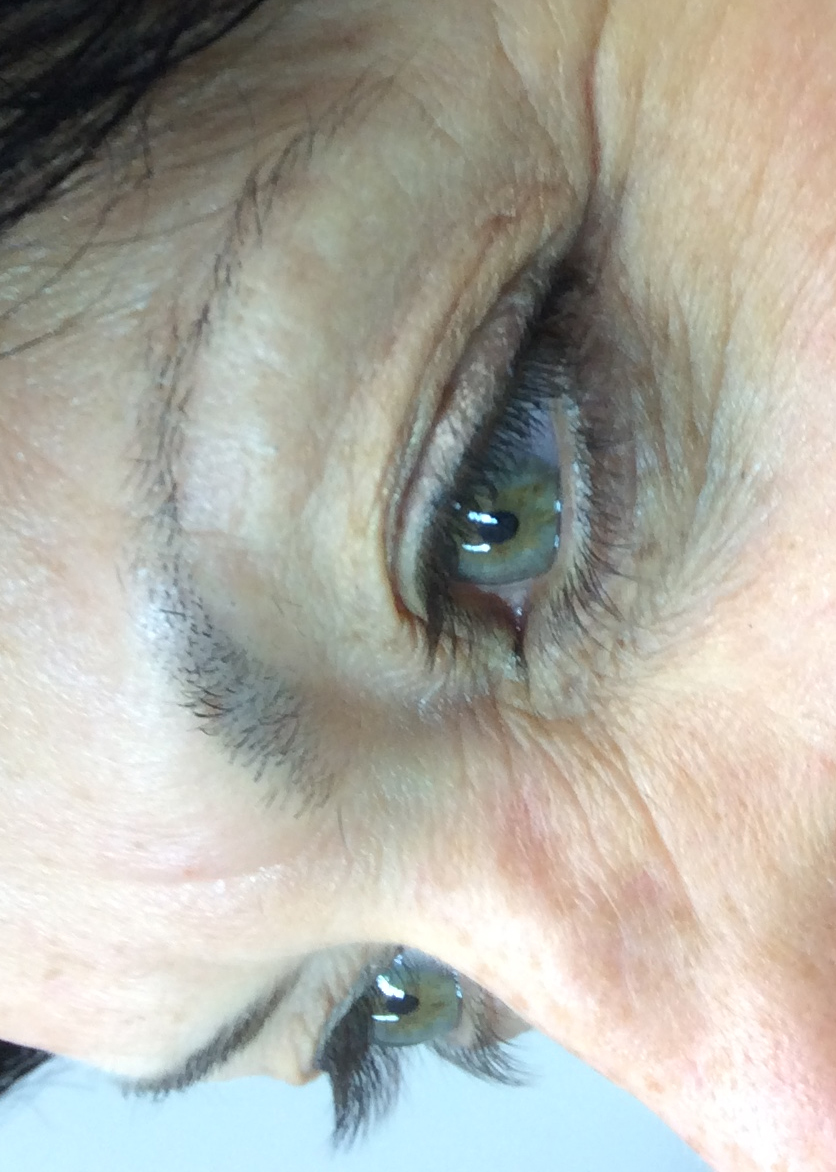 Before Permanent Eyebrow