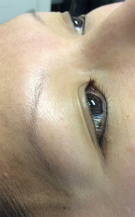 Before Permanent Eyebrow