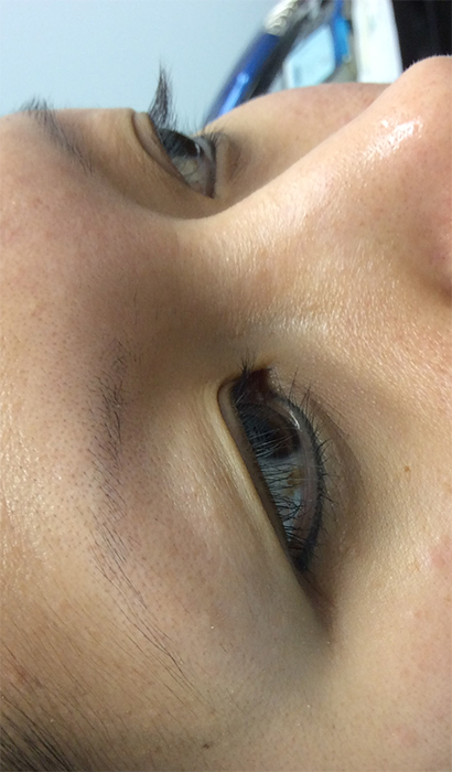 Before Permanent Eyebrow