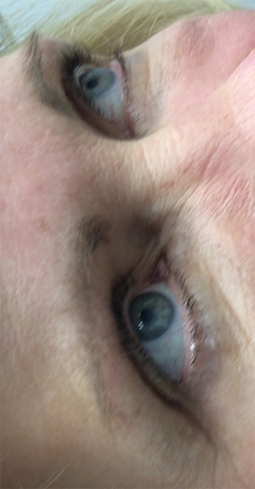 Before Permanent Eyebrow