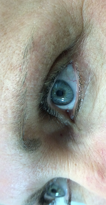 Before Permanent Eyebrow