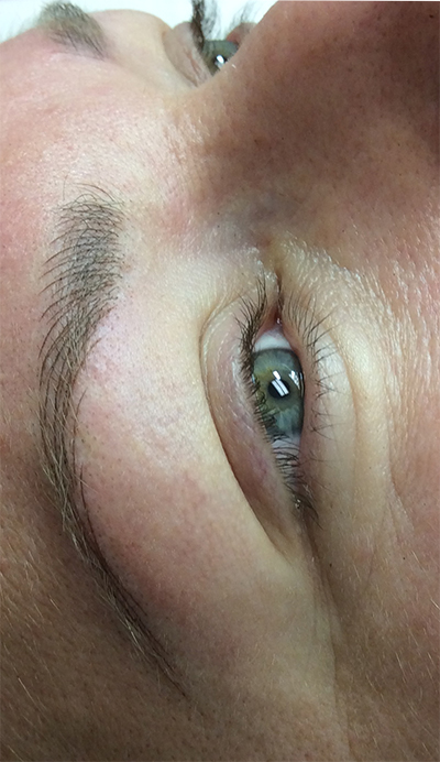 After First Treatment Permanent Eyebrow