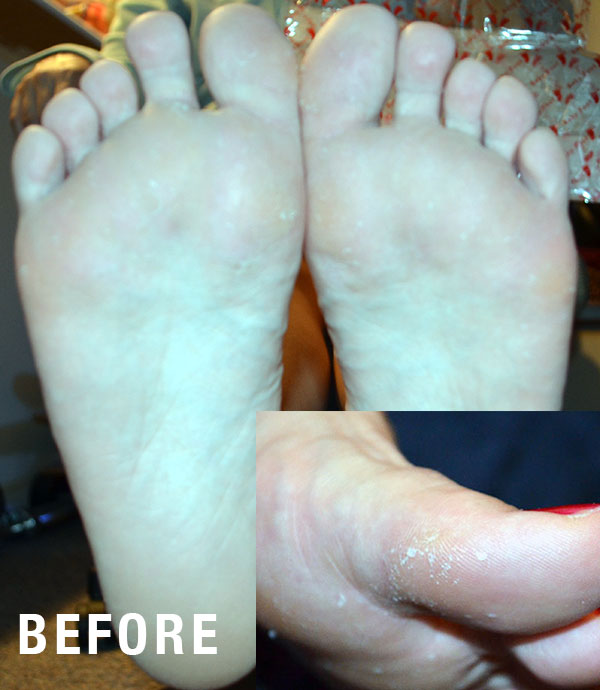 before-baby-foot