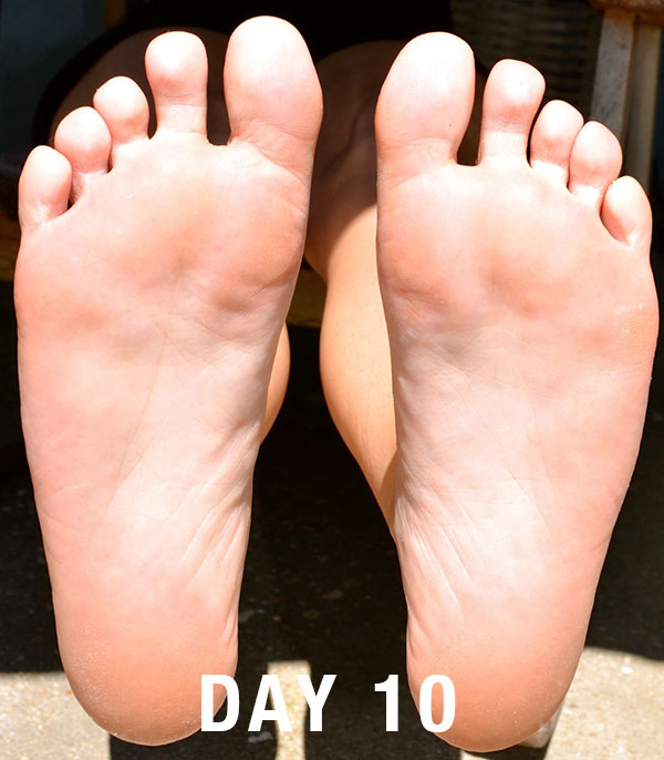 day10